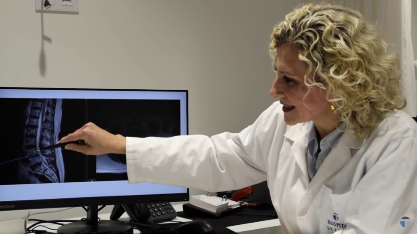 Espondilolistesis: Causas y tratamientos