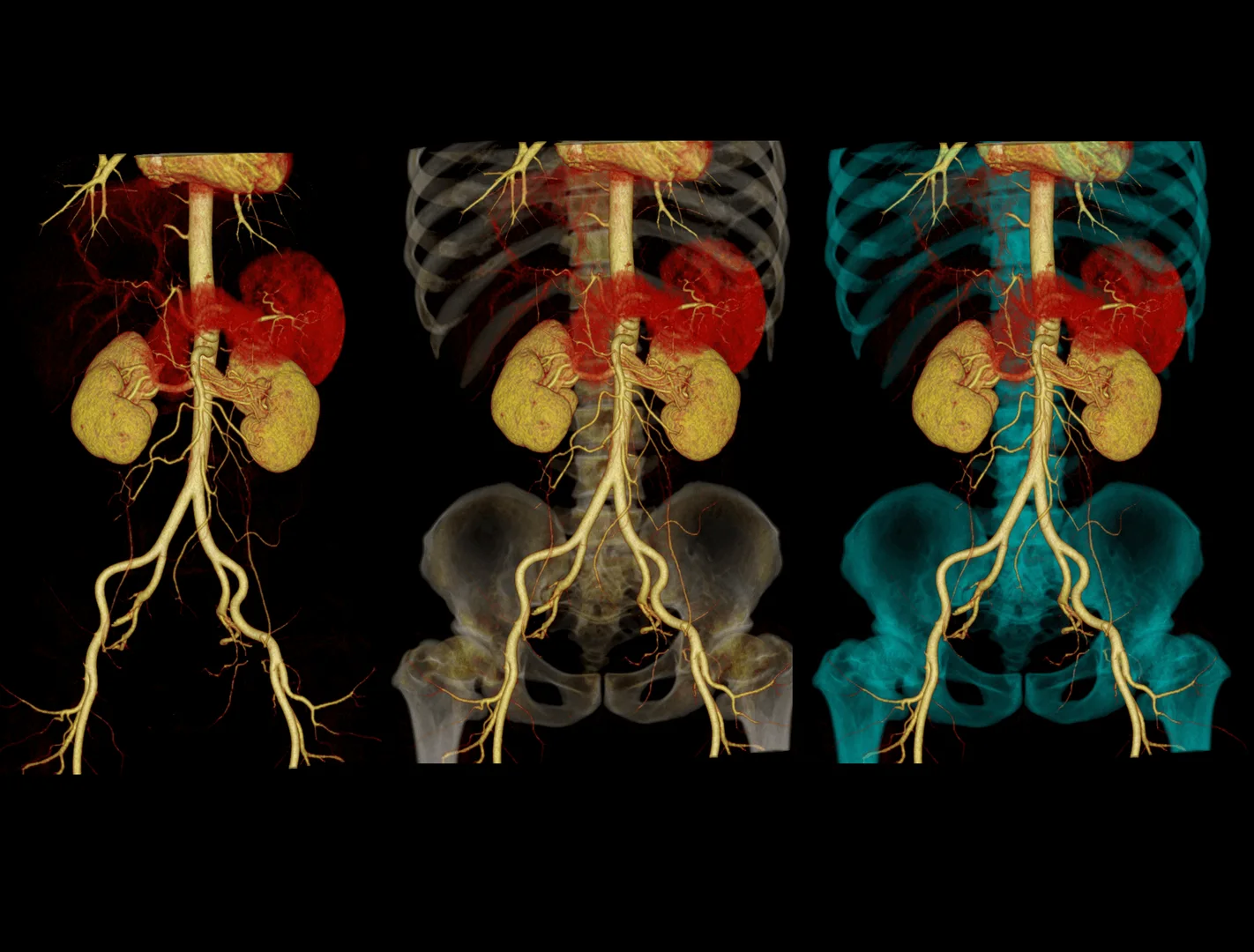 angiotac-abdomen-hospital-vot-madrid